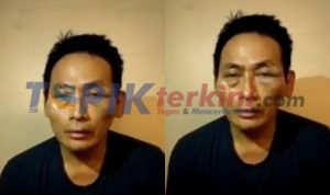 Polisi Tangkap 2 Orang Pelaku Penculikan Relawan Jokowi Ninoy Karundeng