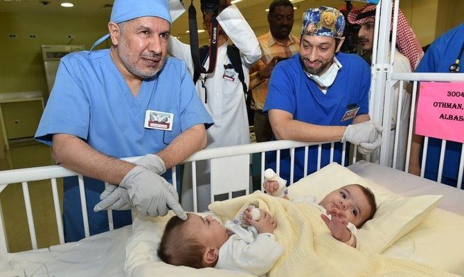 Tim medis Saudi memisahkan kembar siam dari Libya