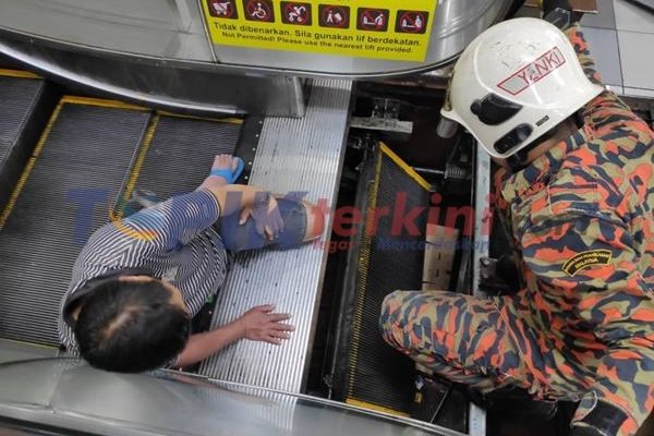 Kaki Pria ini patah setelah terjepit eskalator