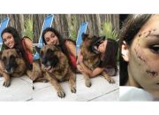 Seorang Model mendapat 40 jahitan setelah anjing menggigit wajahnya saat pemotretan
