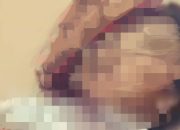 Digigit Anjing, Seorang IRT di Kasintuwu Luwu Timur Meninggal