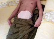 MIRIS..!!! Karena Tak ada Biaya berobat, “TOMI” Warga Desa Lambai Kolaka Utara Terbaring Setahun