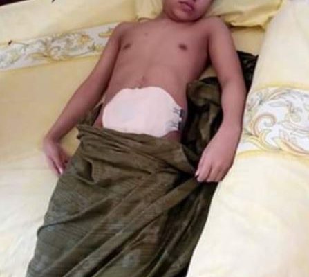MIRIS..!!! Karena Tak ada Biaya berobat, "TOMI" Warga Desa Lambai Kolaka Utara Terbaring Setahun