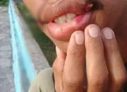 Tidak mengindahkan Himbauan, Seorang Pemuda Di Hajar Petugas Gugus Covid-19