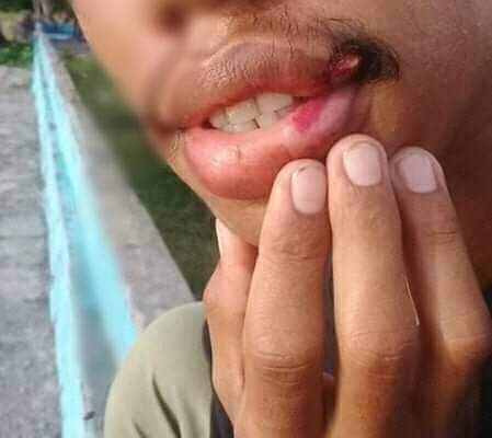 Tidak mengindahkan Himbauan, Seorang Pemuda Di Hajar Petugas Gugus Covid-19