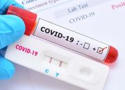 Tiga Orang Warga Sekadau Terkonfirmasi Positif Covid-19