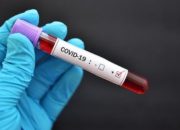 Hasil Swab Keluar, Satu Nakes Puskesmas Ko’mara Dinyatakan Positif Covid 19