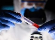 7 Orang Dinyatakan Sembuh, 3 Kasus baru Positif Corona di Buol