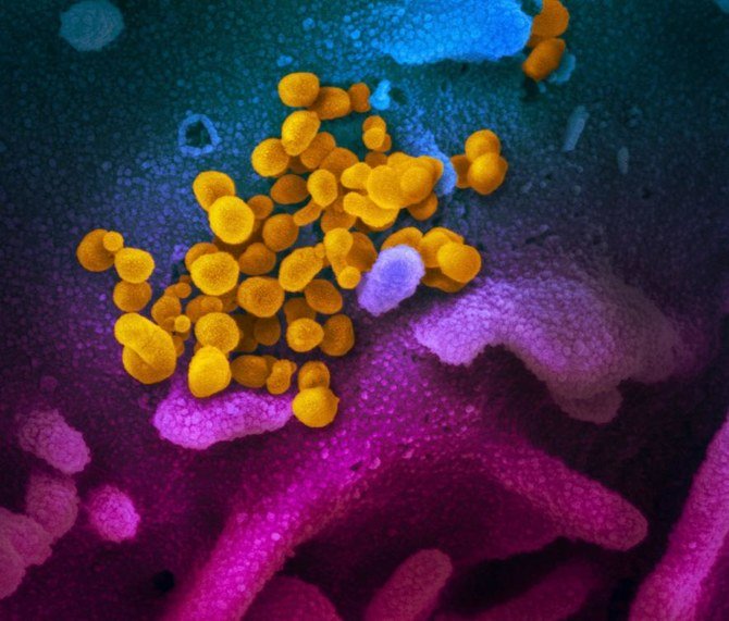 Mutasi coronavirus yang lebih menular sekarang adalah jenis yang paling umum: Peneliti