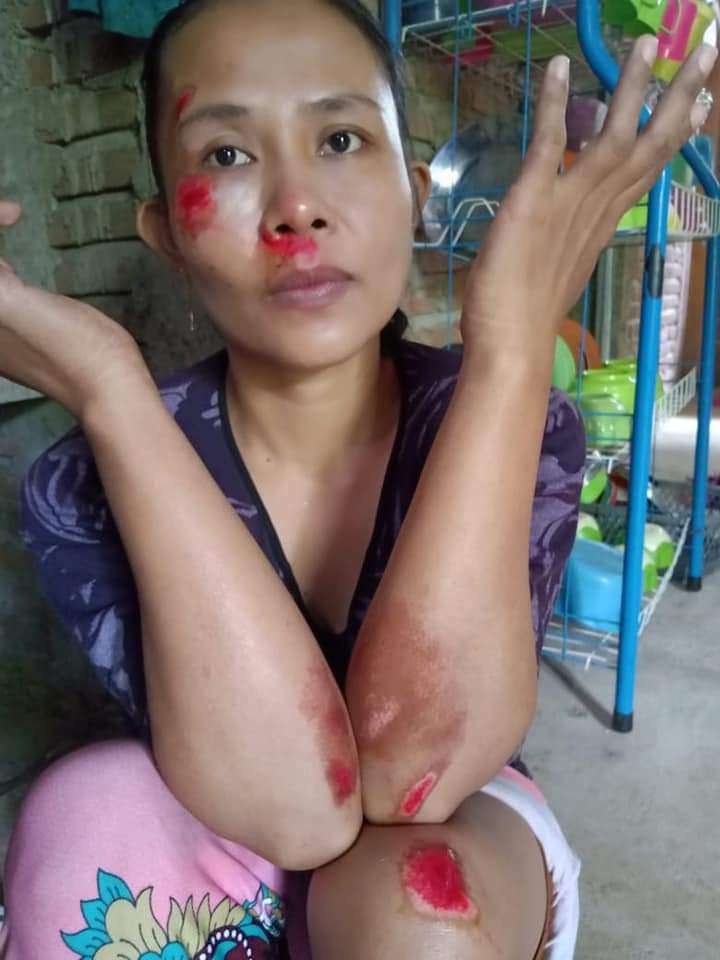 Jadi korban tabrak lari, Warga Desa Tanah Harapan Dilarikan Ke Puskesmas Bontobangun