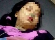 Diduga Malapraktik, Pasca Operasi Caesar, Ginjal Pasien Gagal Fungsi
