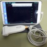 Tekan Angka Kematian Ibu, Sebanyak 4.180 USG Portable Siap Tahun Depan