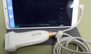 Tekan Angka Kematian Ibu, Sebanyak 4.180 USG Portable Siap Tahun Depan