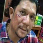 GNPK-RI Besok Demo di Polda Sumut, Yulinar : Poldasu Merupakan Pihak Paling Bertanggungjawab Aksi Brutal Terhadap Wartawan