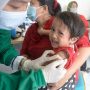 Hepatitis Akut Menular Melalui Saluran Cerna dan Pernafasan, Begini Cara Mencegahnya