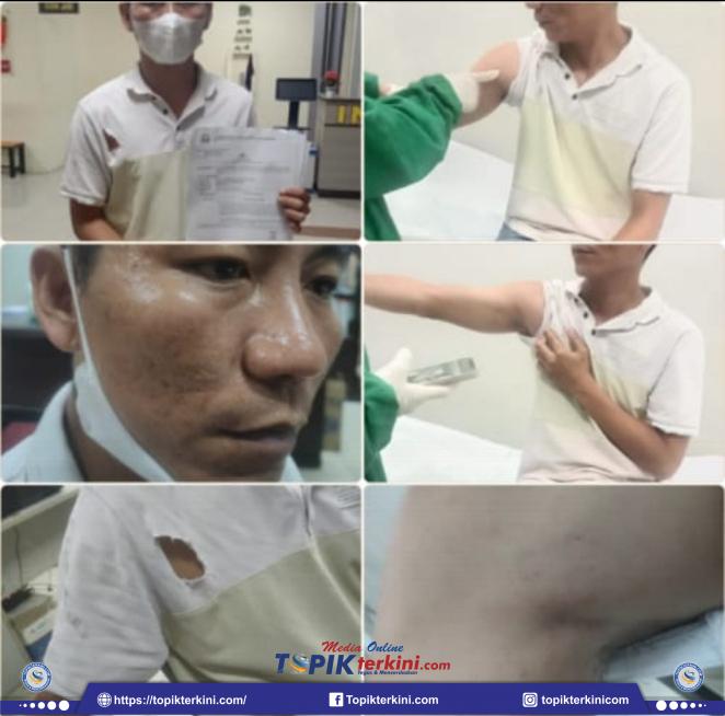 Satu Orang Babak Belur Ini Kasusnya