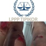 Akibat Jalan Berlubang di THR Kendari, Ketua PASTI Alami Kecelakaan. LPP TIPIKOR -Sultra Angkat Bicara