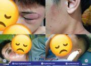 Dua Pemuda Dianiaya Di Bontoramba Jeneponto, Diduga Melibatkan Anggota Brimob Polda Sulsel