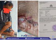 Saling Lapor Mewarnai Kasus Dugaan Penganiayaan Di Bontoramba Jeneponto