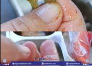 Skandal Dapur MBG Lombok Timur: Ulat Hidup Ditemukan di Makanan Siswa, Pengelola dan IPAL Disorot!