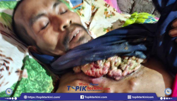 Ketika Muhammad Nur Membutuhkan Perhatian, Keluarga Berharap Pemda Lombok Timur Segera Hadir Ternyata Menghilang!